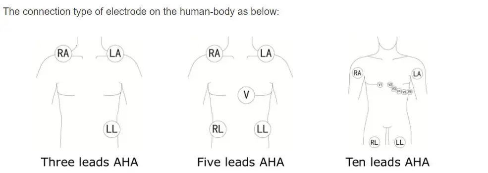 ЕКГ водичи са 5 водича за Пхилипс дигитрак плус 24-сатни холтер 3100А, 5-оловни, Снап
